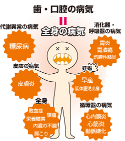 虫歯からおこる全身の病気 虫歯からおこる全身の病気