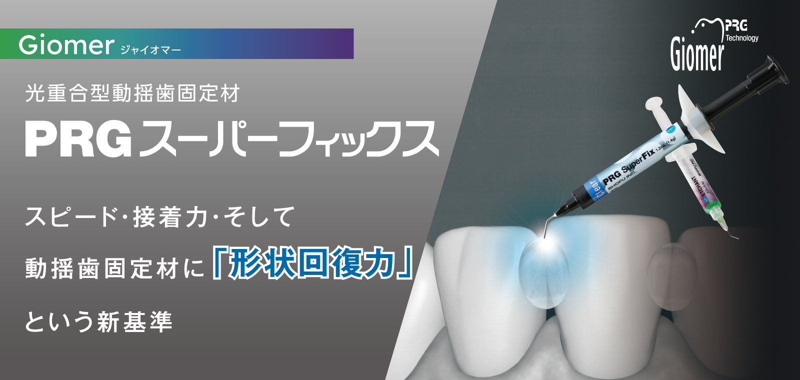 PRGスーパーフィックス発売