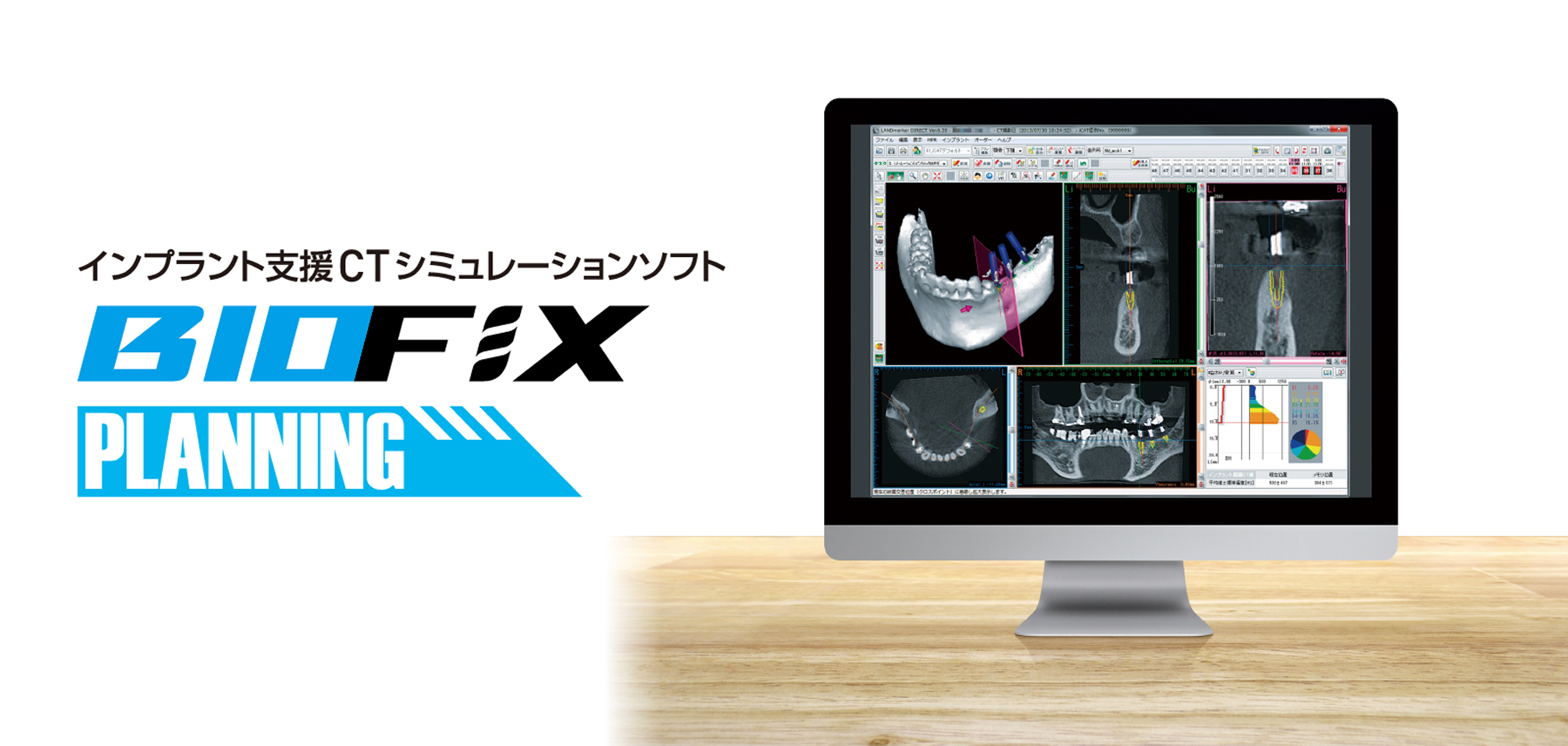 インプラント支援CTシミュレーションソフト