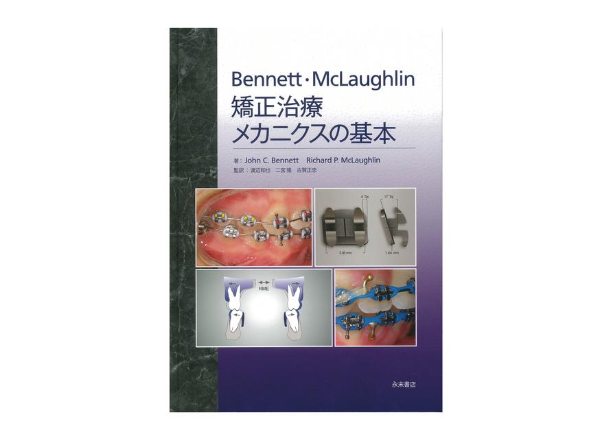 Bennett・McLaughlin 矯正治療メカニクスの基本｜矯正製品│株式会社