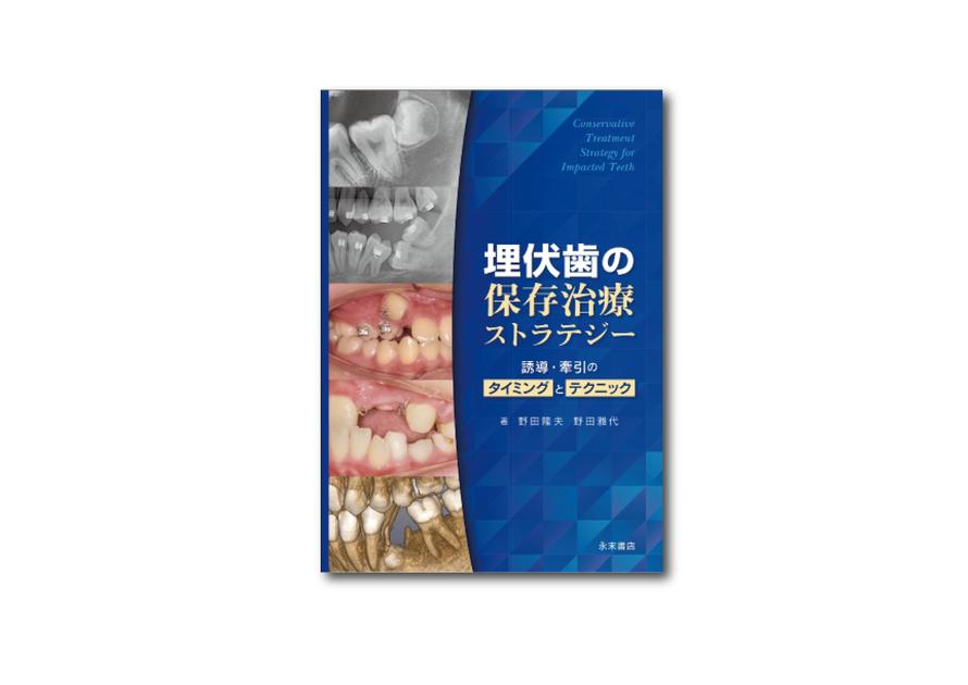埋伏歯の保存治療ストラテジー｜矯正製品│株式会社松風 矯正製品サイト
