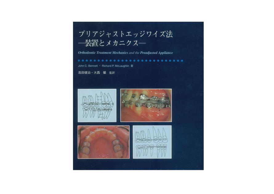 プリアジャストエッジワイズ法 装置とメカニクス｜矯正製品│株式会社