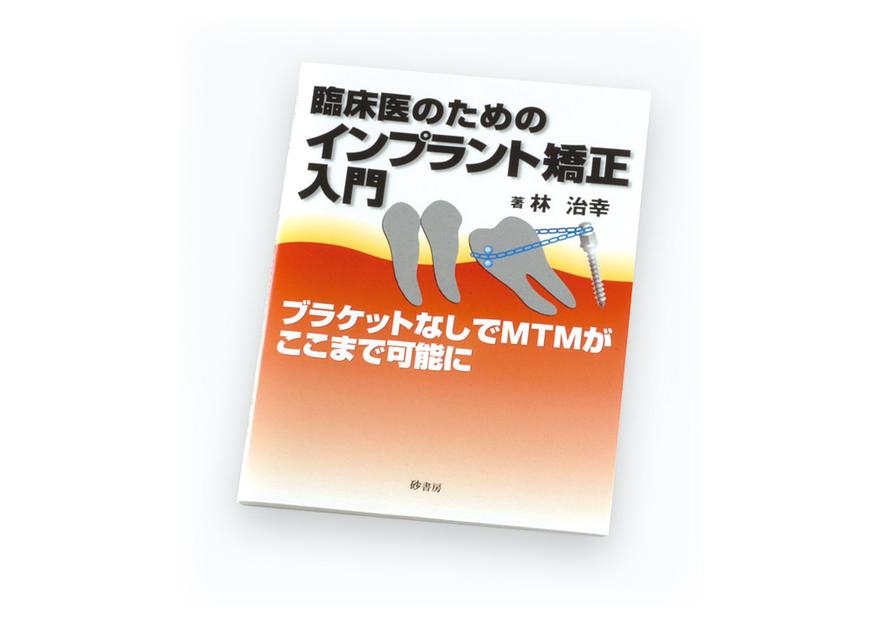 臨床医のためのインプラント矯正入門｜矯正製品│株式会社松風 矯正
