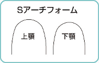 Sアーチフォーム