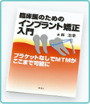臨床医のためのインプラント矯正入門