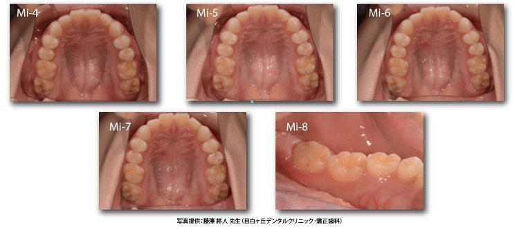 使用例 