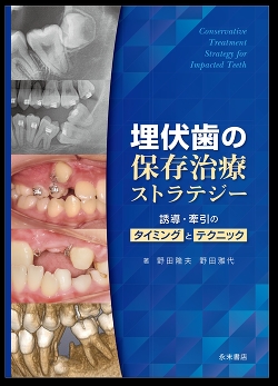 埋伏歯の保存治療ストラテジー