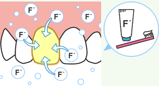 継続してフッ素の効果を得るために