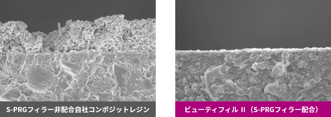 S-PRGフィラー未配合弊社コンポジットレジンではプラークが形成され、ビューティフルⅡ（S-PRGフィラー配合）ではプラークの形成が抑えられている