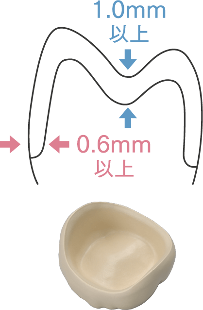 大臼歯の咬合面とマージン部に関する図