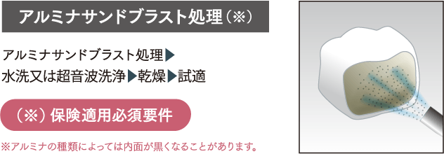 アルミナサンドブラスト処理