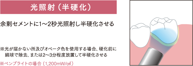 光照射（半硬化）