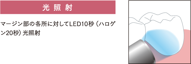 光照射