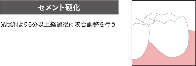 セメント硬化