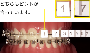 どちらもピントが合っています。
