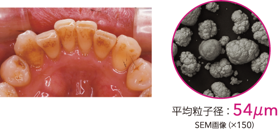 平均粒子径：54μm SEM画像（×150）
