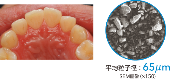 平均粒子径：65μm SEM画像（×150）
