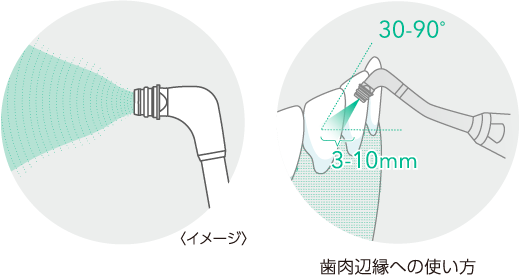 イメージ・歯肉辺縁への使い方