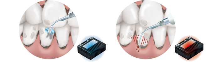 オートチューニング機能