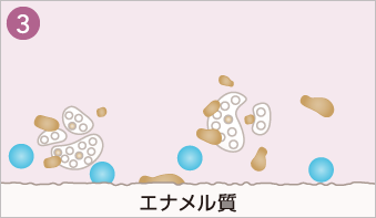 徐々に砕けるケイソウ土と小さなシリカで歯面を整える