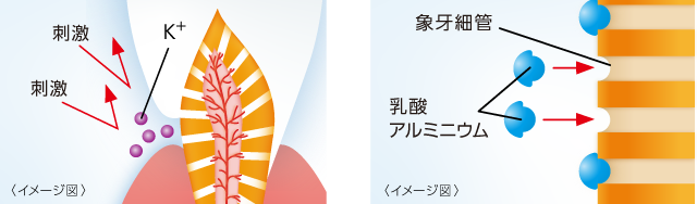 乳酸アルミニウムが象牙細管を封鎖
