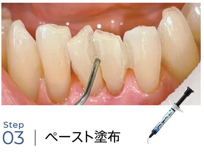 ペースト塗布