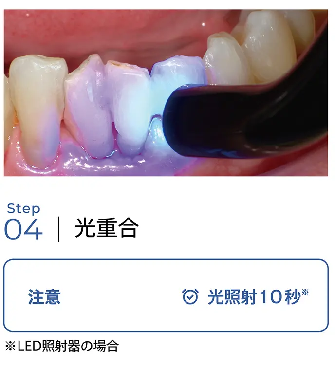 光集合