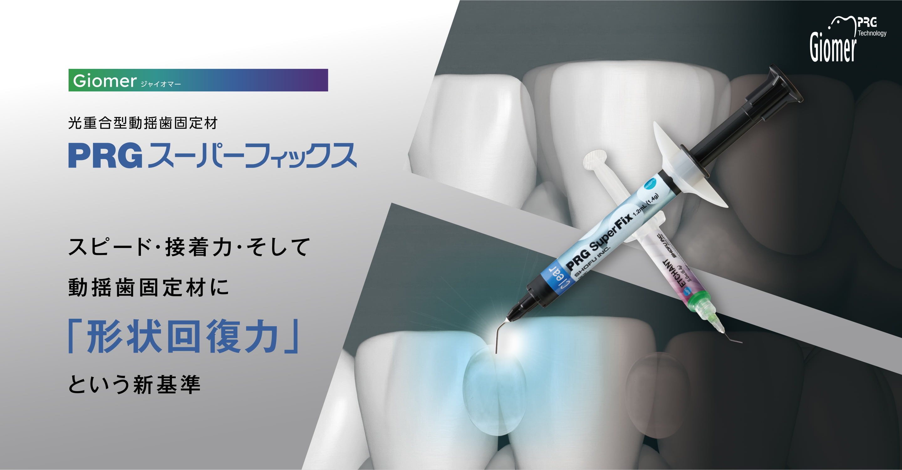 PRGスーパーフィックス