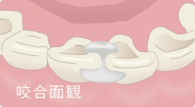 塗布