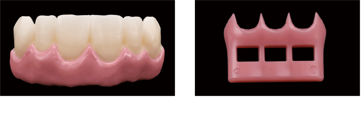 (左)下地にG1を塗布したジルコニア、（右）ヴィンテージ ガミーNo.1（ライト）