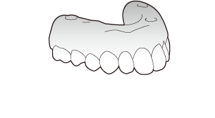 ロングスパンブリッジ※4
