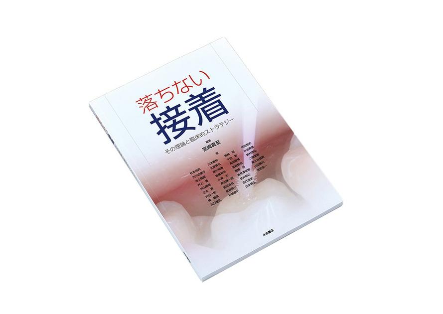 落ちない接着｜製品情報｜株式会社松風
