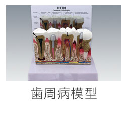 歯周病模型