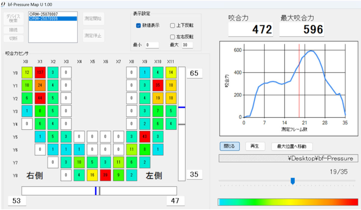 oramo2_application.jpg