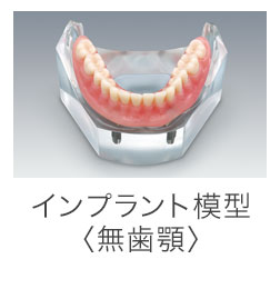 インプラント模型＜無歯顎＞