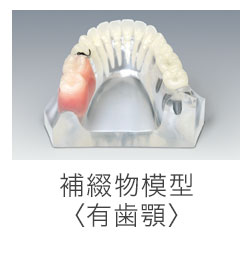 補綴物模型＜有歯顎＞