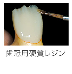 歯冠用硬質レジン