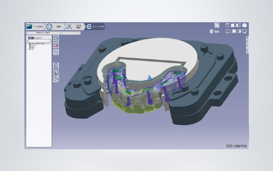 GO2dental（松風仕様）Ver.6.09