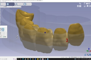 「傾斜配置（３D移動）」