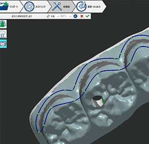 「アンダーカット加工モード」
