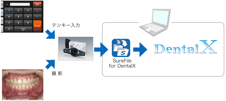 アイスペシャルC-Ⅱ C-Ⅲ | 「松風シュアファイルfor DentalX」の概要