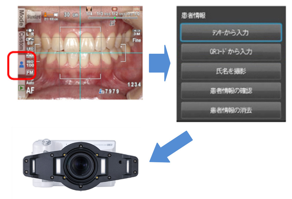 アイスペシャル C-Ⅲ 歯科用口腔内用カメラ